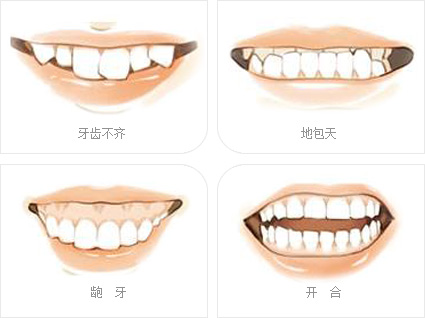 牙齿矫正对象